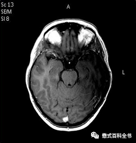 硬件系统五大组成部分_硬件系统_硬件系统最核心的部件